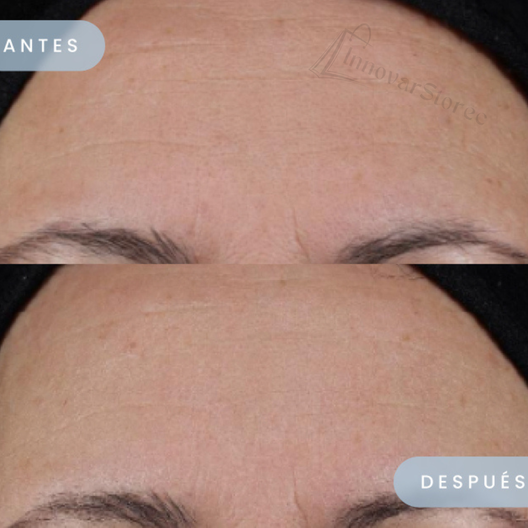 ✨Colagenix™ - Parche Antiedad Frente y Mejilla (12 unidades) ✨