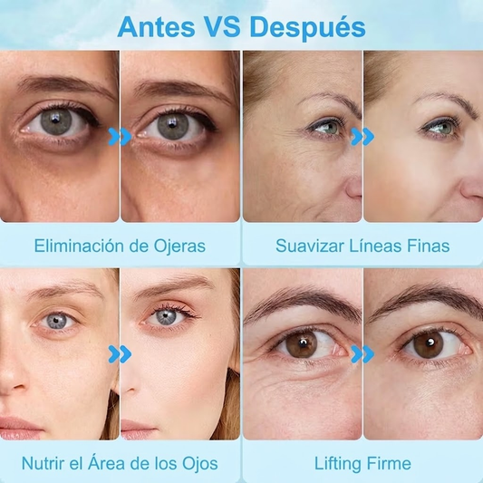 Flamenco™ Hydrogel Eye Patches